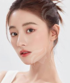 胡小清双眼皮怎么样？医生介绍及小贴士分享