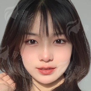 北京割双眼皮好医院医生推荐，美莱叶宇/丽合薛轶群/联合丽格吴玉家/惠合嘉美亓敏/艺星王博谦