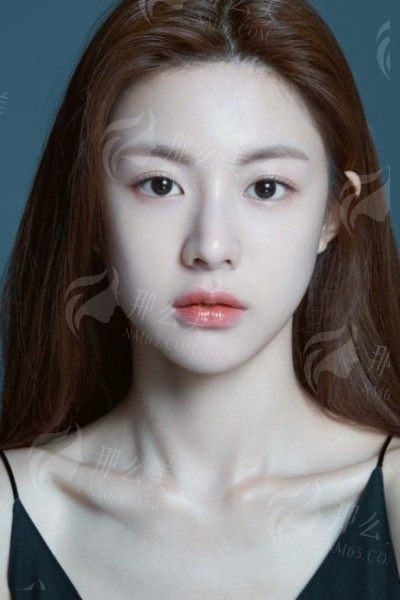 深圳星禾医疗美容双眼皮：体验分享，真实案例，术后小知识