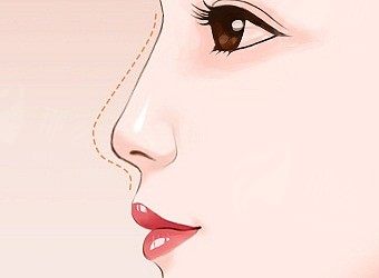 广州美恩隆鼻效果怎么样？全方位评测来了，附预约方式