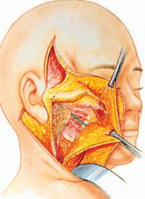 上海艺星整形除皱费用是多少？文连玉医生临床工作24年，注射除皱价格1910元起
