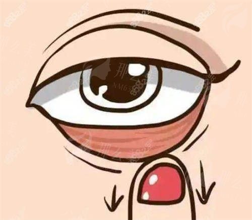 济南祛眼袋医生排名：郭俊波/杜娟/王召东等医生详细介绍-医生真实评价