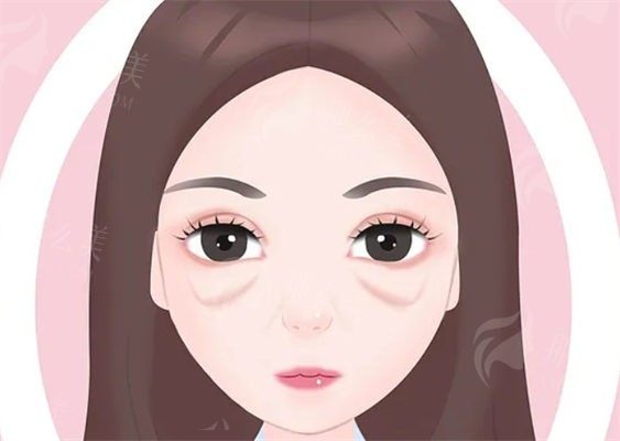 青岛祛眼袋医生排名：林建新/赵琳/白永辉上榜，超声法去眼袋价格1709元起