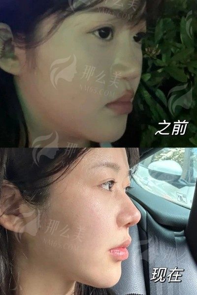 广州健丽医美整形价格明细：高性价比，让你美丽无忧！   
