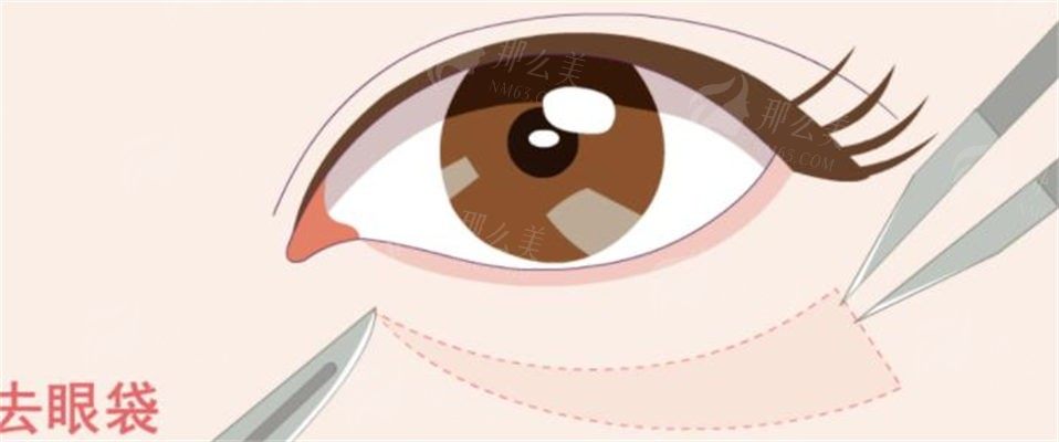 北京医院双眼皮医生推荐：北京医院马晓冰/鲍世威医生整形专家