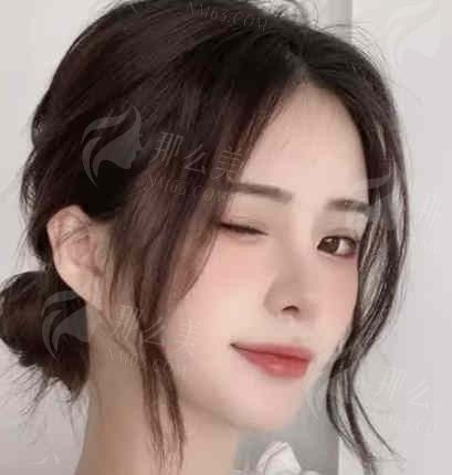 上海六院割双眼皮效果如何？医生名单&热门项目&价格介绍