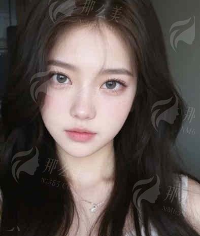 邯郸市第七医院整形美容科大起底：眼部整形疑问全解析！