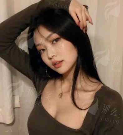 悦好整形假体隆鼻：最新价格一览，客户好评如潮