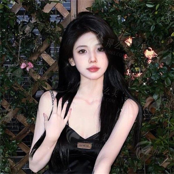 济南哪里做双眼皮好看？哪家医院做双眼皮风格比较自然？