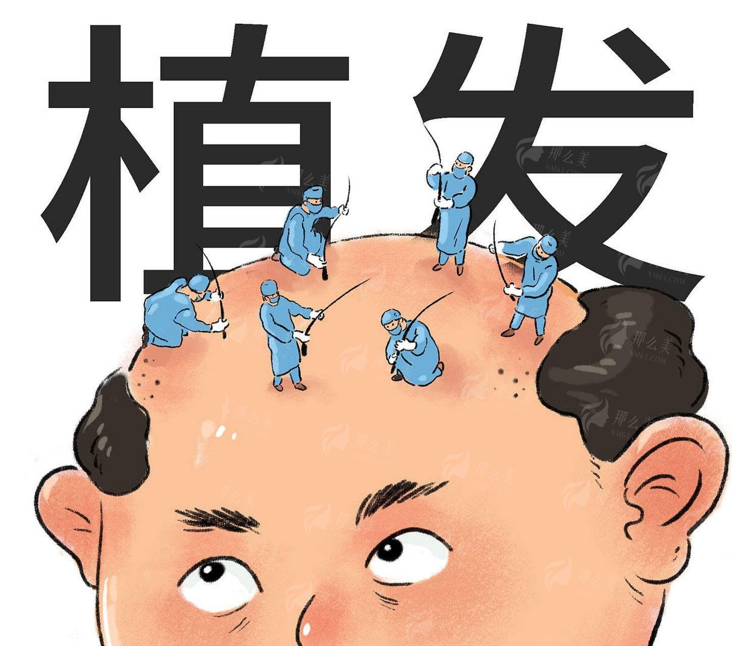 深圳微针植发医院有哪些？推荐这五家，疤痕种植价格924元起