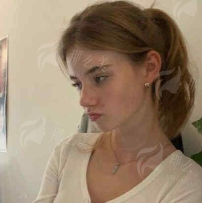 杭州艺星和格莱美哪家更靠谱？两家医院实力对比！