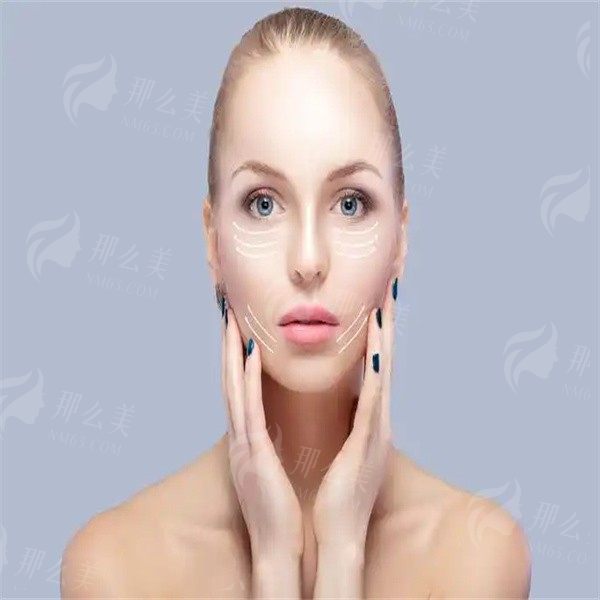 广州华美哪个医生做拉皮好?医院信息及案例分享