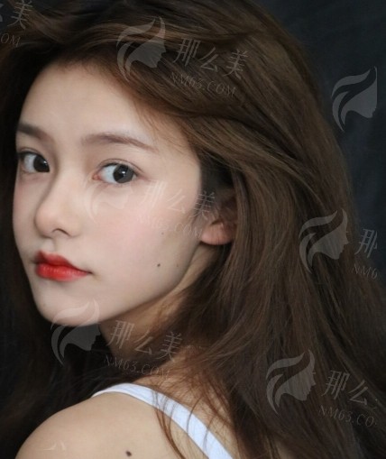 济宁眼部整形专家及价格全解析