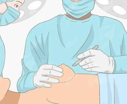 汪灏医生简介整形怎么样？附上参考价格介绍，含医生资料详情