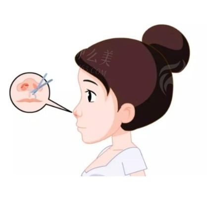 曹海峰个人简介分享!曹海峰擅长隆鼻，坐诊江苏施美尔整形美容医院，医生信息、坐诊医院信息公布