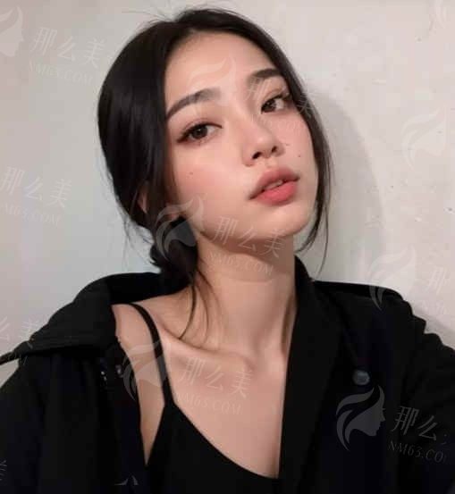 惊爆！无锡二院美容激光中心真面目曝光，热门项目有哪些亮点？