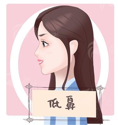 漳州鼻整形大咖医生名单公布：张贤期/王力佳/曹宁医生领衔-鼻孔缩小3531元起-求美者评价公布