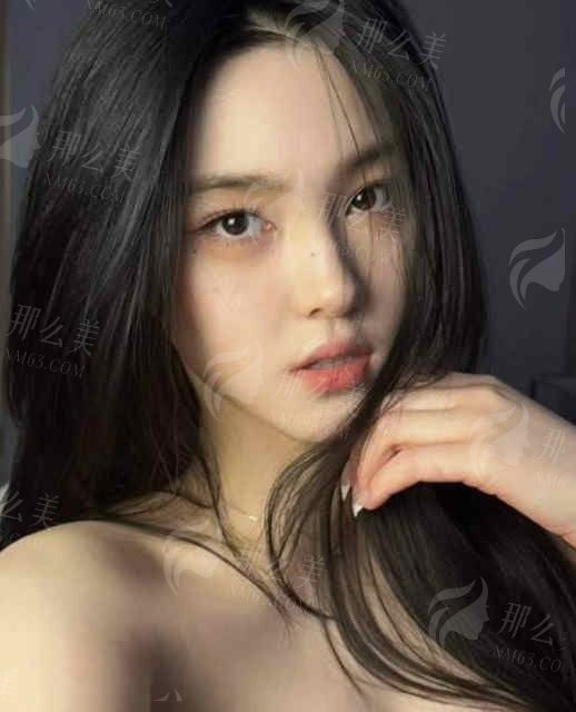 成都赫拉臻颜怎么样？热门项目及案例参考，真实用户体验分享
