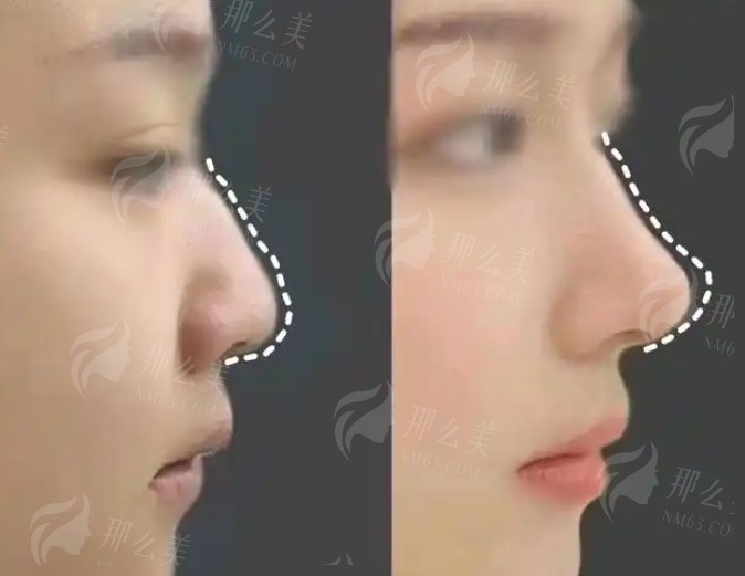 杨军稳在南京的口碑和影响力评价分享！价格表、经典案例