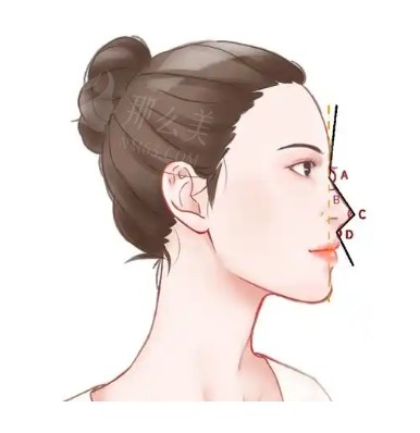 广州军美隆鼻多少钱？广州军美擅长自体软骨隆鼻/歪鼻矫正/假体隆鼻等，隆鼻价格9800元起~