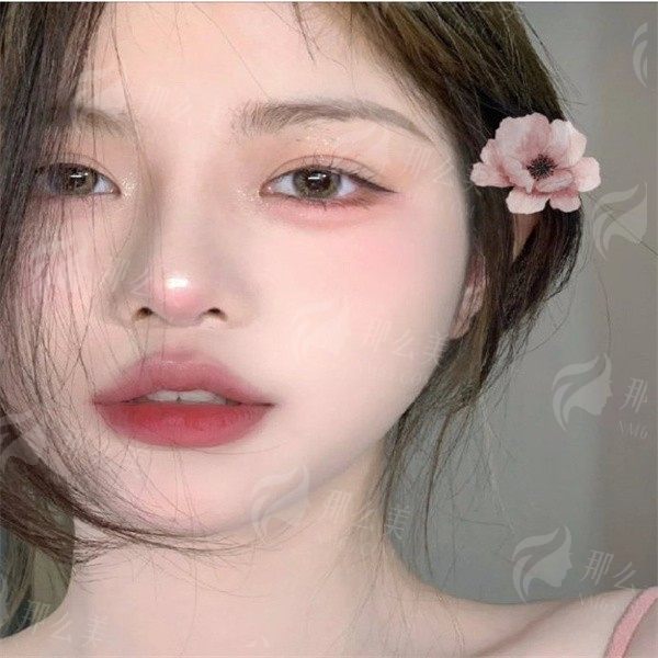 武汉仁爱时光割双眼皮医院怎么样？医院详细介绍与口碑点评