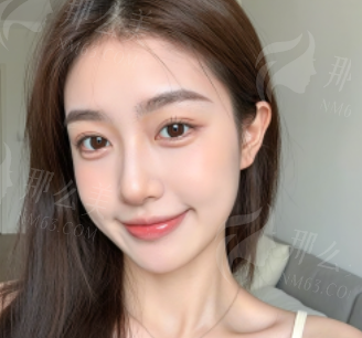 深圳隆鼻哪里做的好？深圳鹏爱整形李罡/蔡国威/李典谕隆鼻技术口碑都不错预约方便
