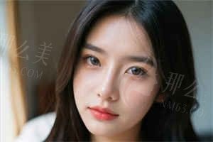西安首瑞植发医院杜亮医生女性发际线种植价格8元每毛囊起预约方式介绍