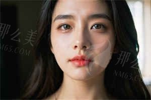 广州面部拉皮手术价格大揭秘！从2万到9万10类费用对比+避坑指南