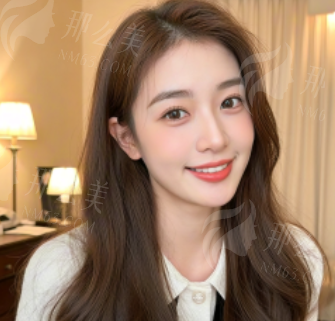 深圳日式无痕双眼皮哪里做的好？深圳米可整形陈敬武日式无痕双眼皮效果技术好，附案例&地址