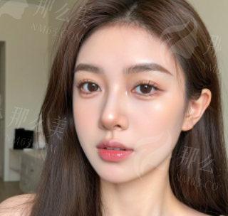 深圳皇佳亿美整形吉速双眼皮效果好不好？吉速双眼皮价格-24小时电话在线预约