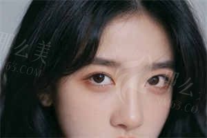 长脸可以做缩短手术吗？宽下巴矫正手术方与价格介绍