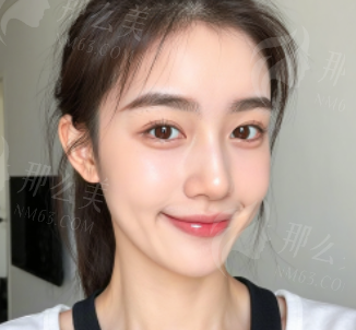 温州艺启美整形口碑好不好-24小时电话预约温州艺启美整形提眉-案例、价格公布