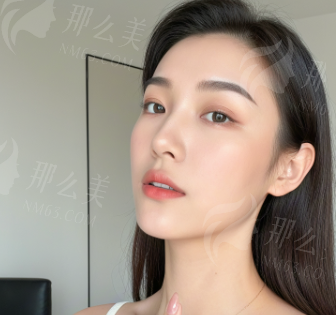 深圳安美聚光整形苏博面部抗衰玻尿酸注射怎么样？苏博面部注射优势-案例-地址