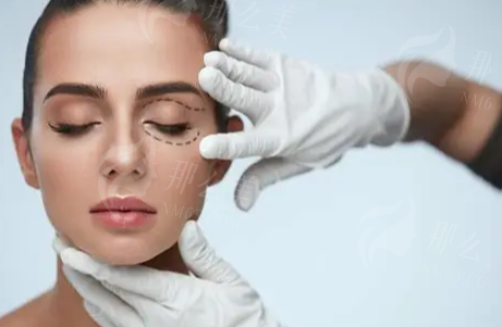 为什么那么多人找何金光医生做整形？口碑效果案例好附价格参考