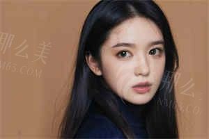 挛缩鼻修复：李娟医生的技术实力与性价比分析，附价格参考