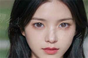 宁波鄞州艺星卜双燕医生祛痤疮凹疤：痘坑不是烙印，千元级修复能逆袭吗？