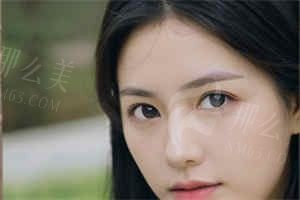 上海24小时咨询/预约双眼皮好医院推荐附地址电话，不走冤枉路