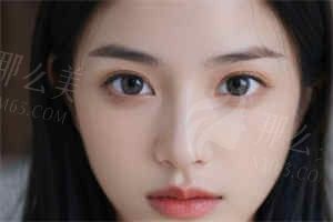 金华心艺医美靠谱吗？双眼皮修复&隆鼻详细价格曝光！