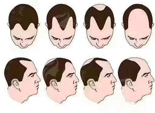 f2c02b25b3be8811f559ef2cd3fcbe7f