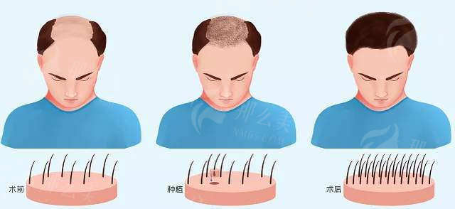 cf5062ee3518c33f68365d975bc87f43