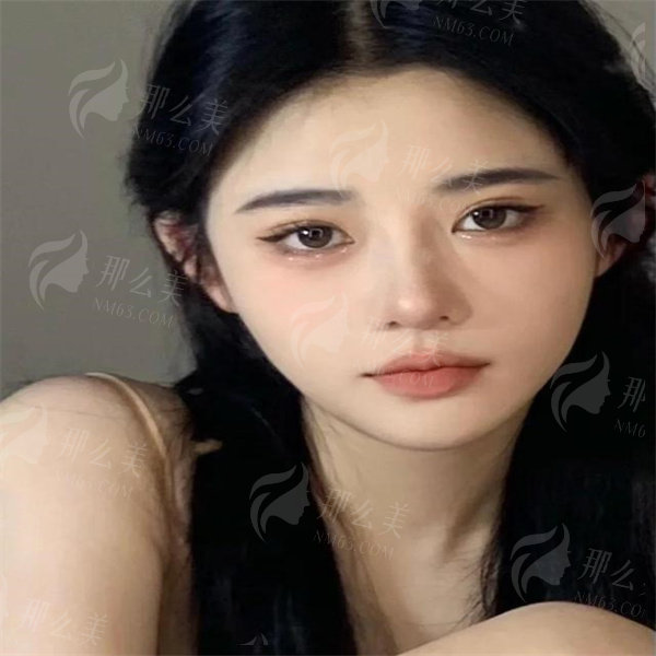 c995d143ad4bd113be4b8cc07fcc49064afb052e.jpg