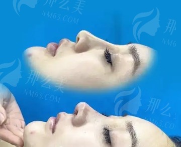 微信截图_20250220103436