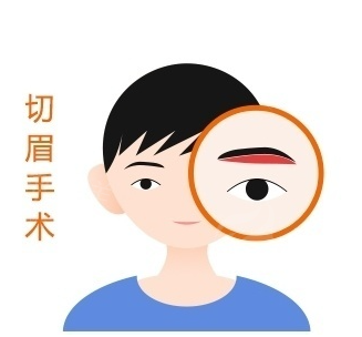 切眉
