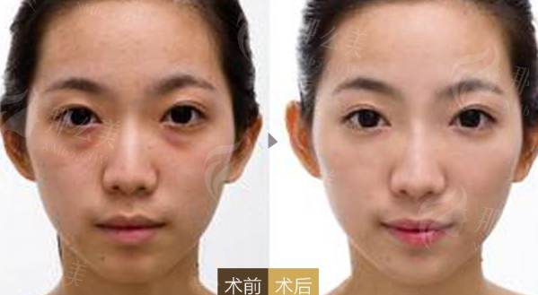 1740031601368099.png image.png