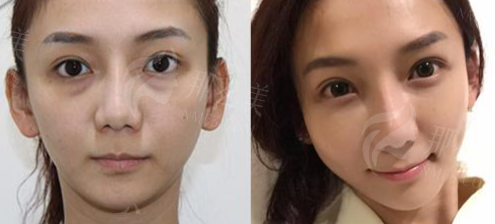 1740033388245954.png image.png