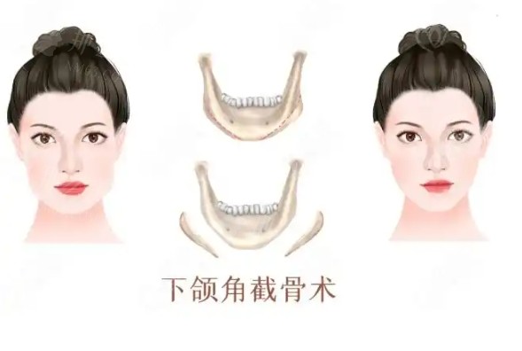微信截图_20250225095503