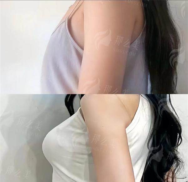 1740551902315155.jpg 99b626cdly1hs6k0hisa3j20u013y451.jpg