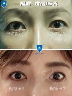 微信截图_20250227093314
