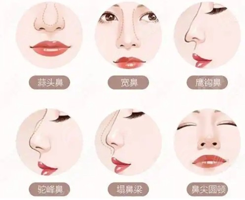 微信截图_20250303085708