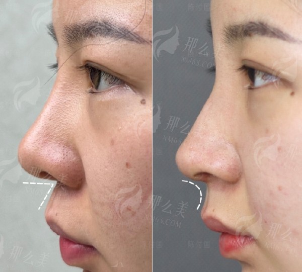 微信截图_20250220103342